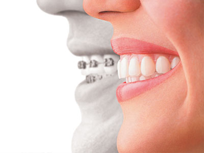 AV Dental | Emergency Treatment, Extractions and Dental Cleanings