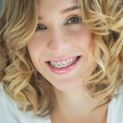 AV Dental | Veneers, Preventative Program and Sports Mouthguards